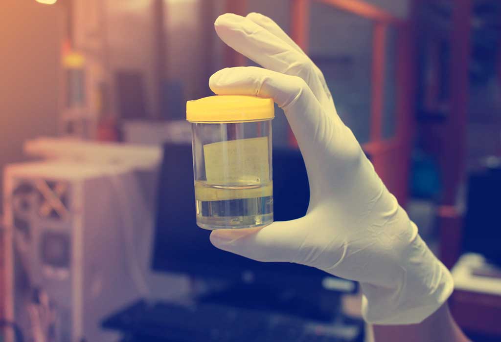 قسم الطفيليات  Parasitology Department