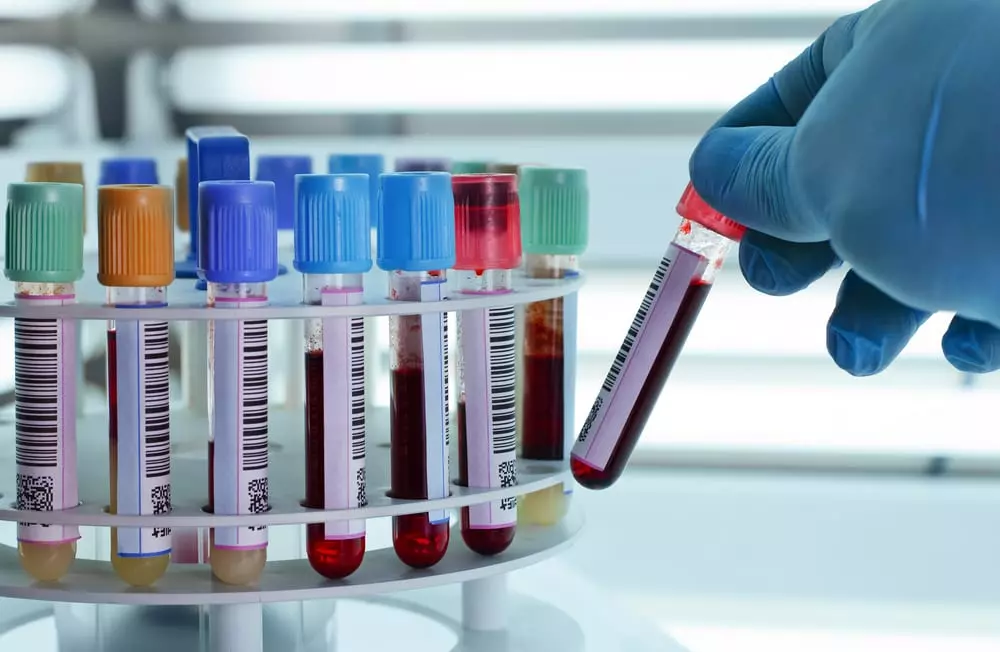 قسم الدم العام Hematology Department
