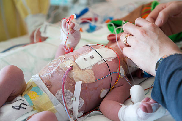 قسم العناية المركزة للأطـفـال PICU